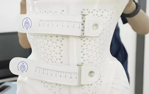 3D打印，正在改变传统康复支具行业