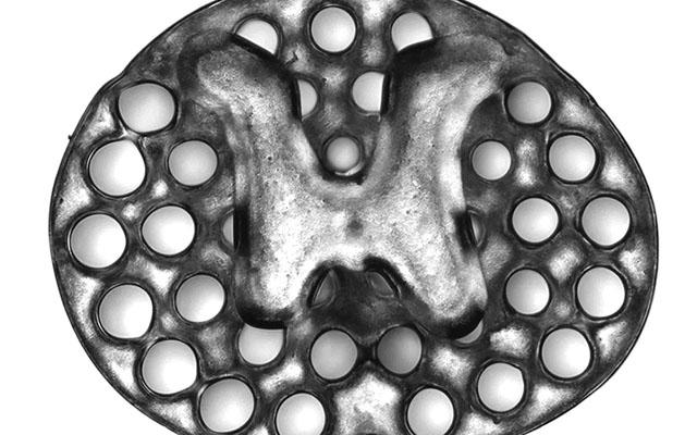 3D打印医疗应用：3D打印脊髓支架成功植入小鼠脊柱治疗脊髓损伤，人体脊髓损伤有望治疗.jpg