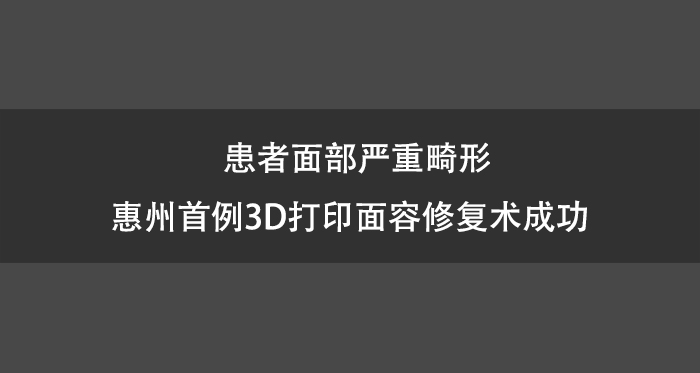 患者面部严重畸形 惠州首例3D打印面容修复术成功.jpg