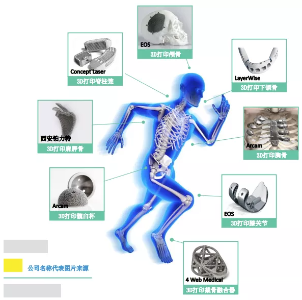 骨科植入体的3D打印趋势化—优质产品的高质需求 (1).png