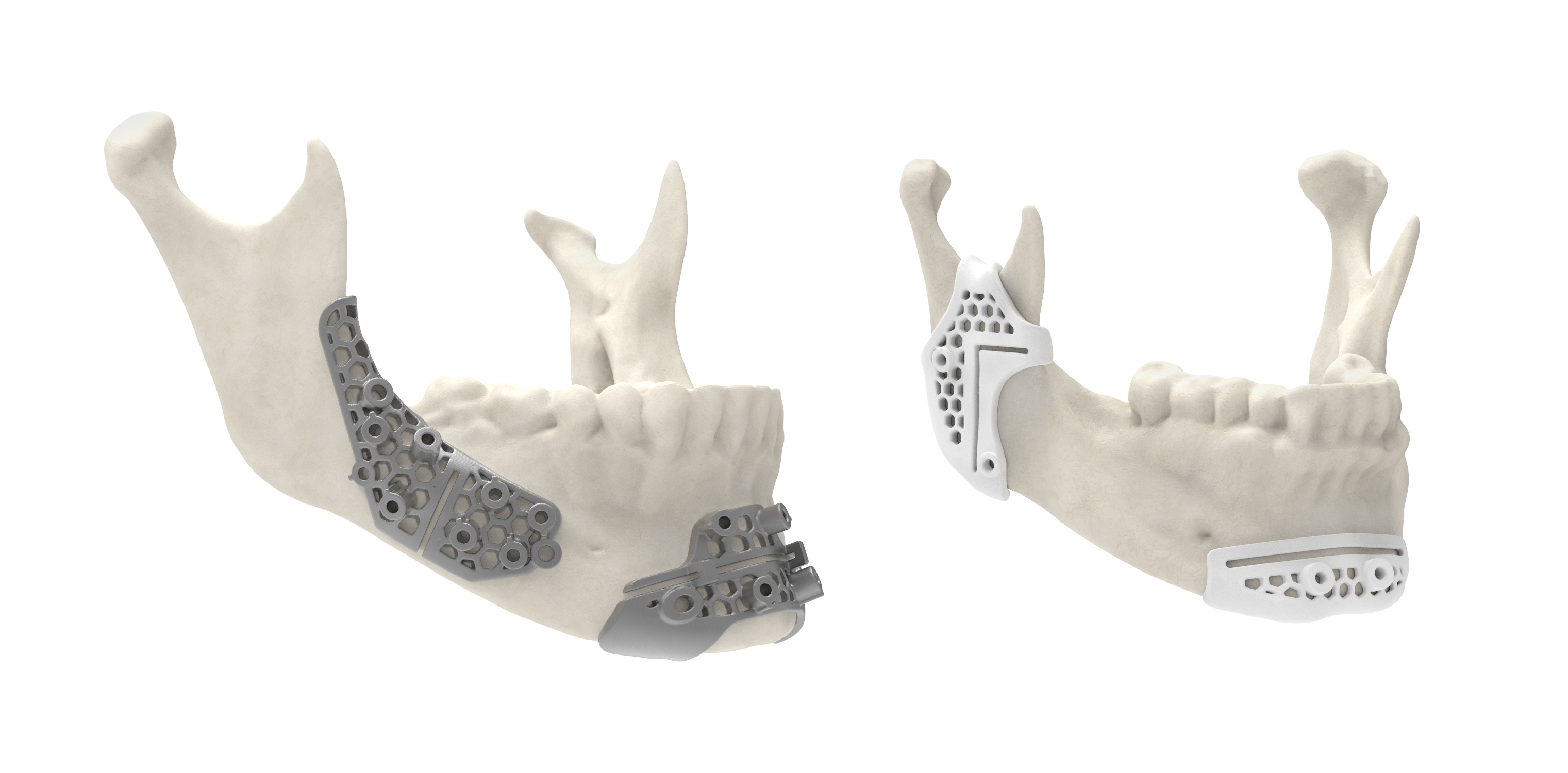 3D Systems以4.3亿的价格出售Cimatron软件业务，净亏2亿 (1).jpg