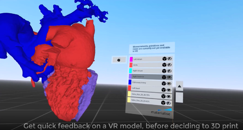 Materialize将VR集成到Mimics软件中，以获得更好的3D解剖模型 (2).png