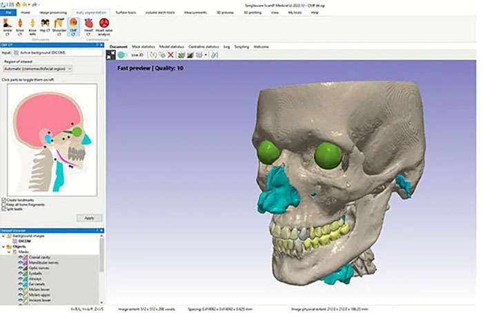 Synopsys推出最新版本 Simpleware 3D图像处理软件.jpg