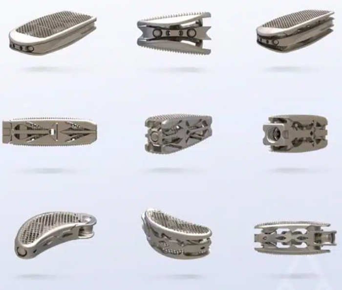 Additive Surgical推出一系列可扩展的椎体间植入物.jpg