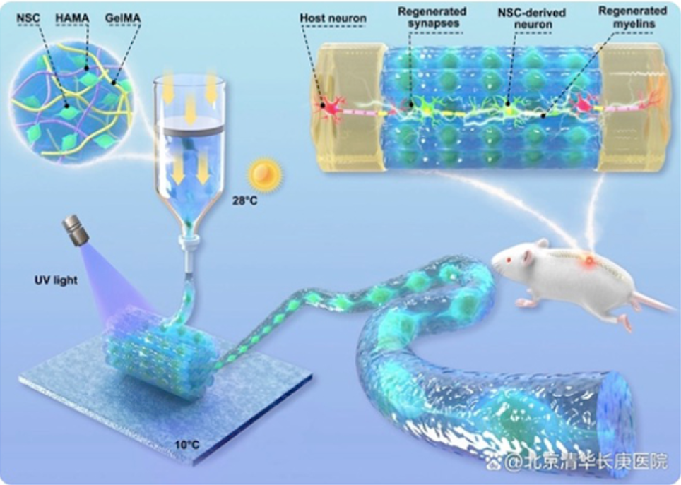 清华长庚与清华大学合作发表生物3D打印技术治疗脊髓损伤新策略.png