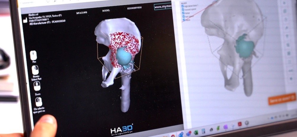 3D打印医疗模型如何让手术更安全？ (2).jpg